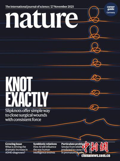 研究成果发表于国际顶级期刊《自然》并登上杂志封面。研究团队供图