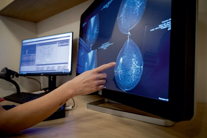 转移性乳腺癌患者迫切需要新的治疗方法。