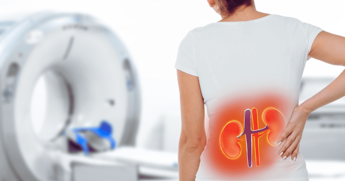 2025年1-12月:干细胞治疗狼疮性肾炎最新临床进展汇总 2025年1-12月:干细胞治疗狼疮性肾炎最新临床进展汇总