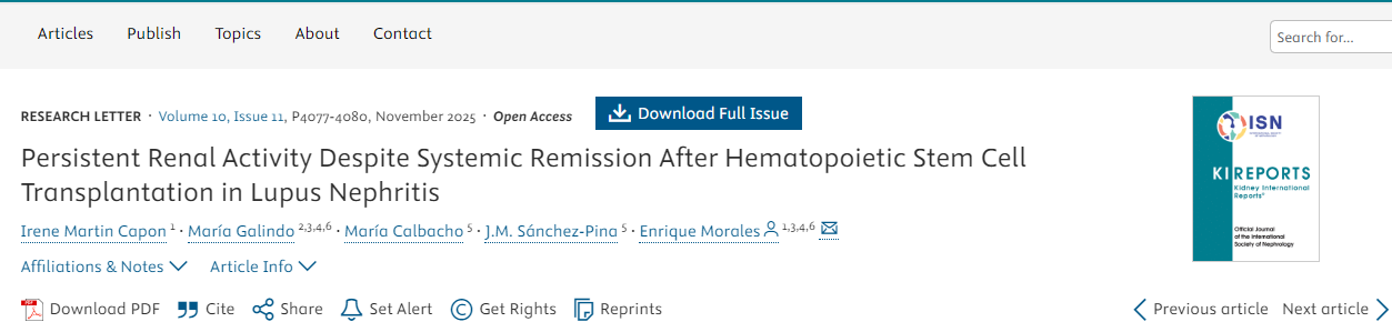 狼疮性肾炎患者接受造血干细胞移植后,尽管全身症状缓解,但肾脏活动仍持续存在 狼疮性肾炎患者接受造血干细胞移植后,尽管全身症状缓解,但肾脏活动仍持续存在