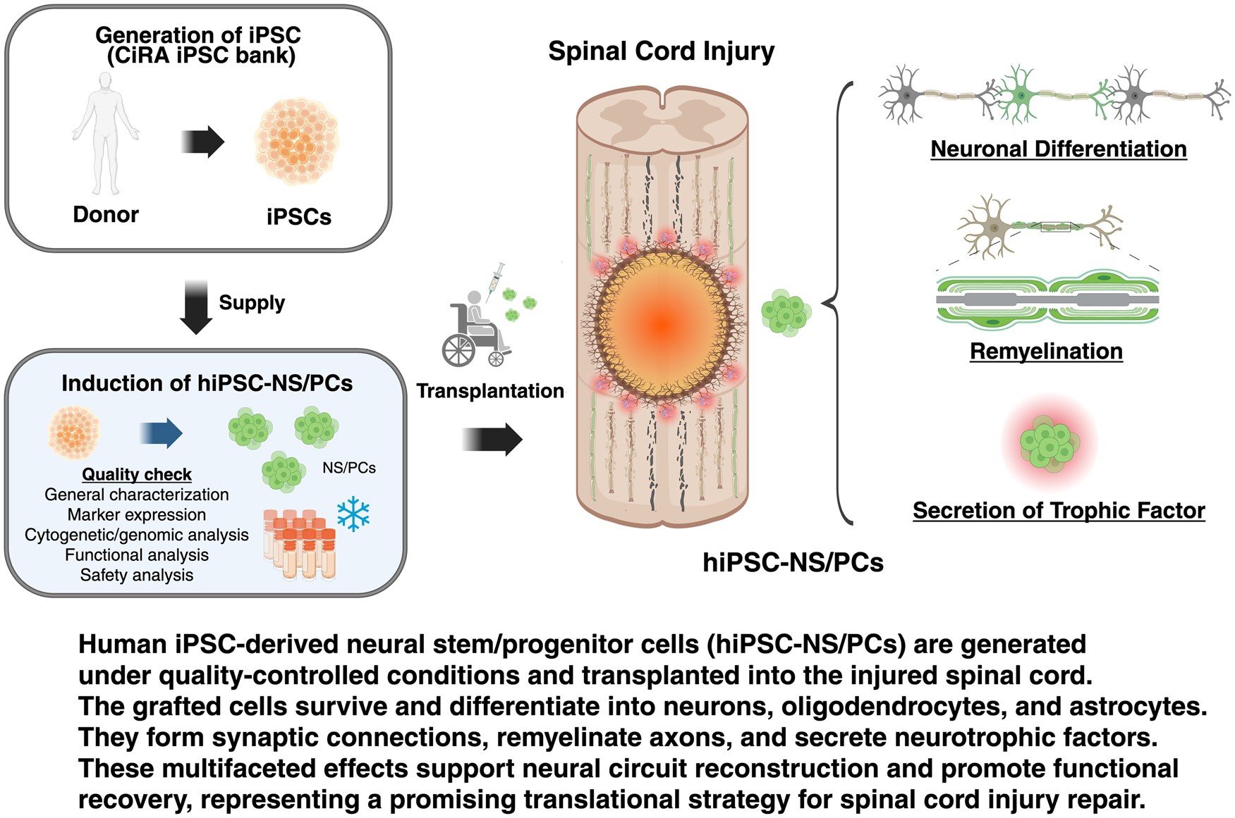 最新综述！多能干细胞来源的神经干/祖细胞疗法治疗脊髓损伤：临床进展和转化展望