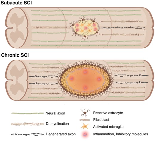 图2：脊髓损伤后亚急性期和慢性期的病理特征。
