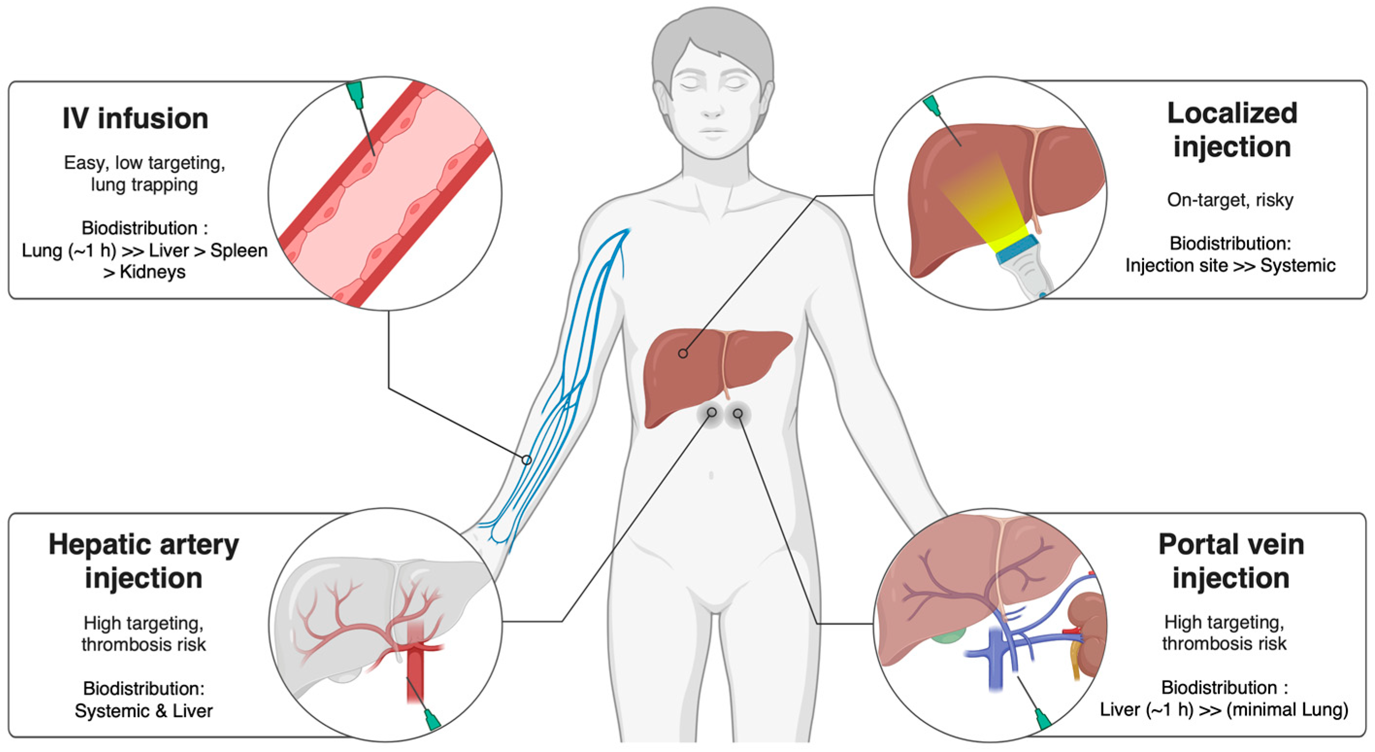 图2：MSCs和EVs在肝病治疗中的递送途径。生物分布和治疗效果会受到给药途径的影响，例如静脉注射、门静脉注射、肝动脉注射或局部注射。
