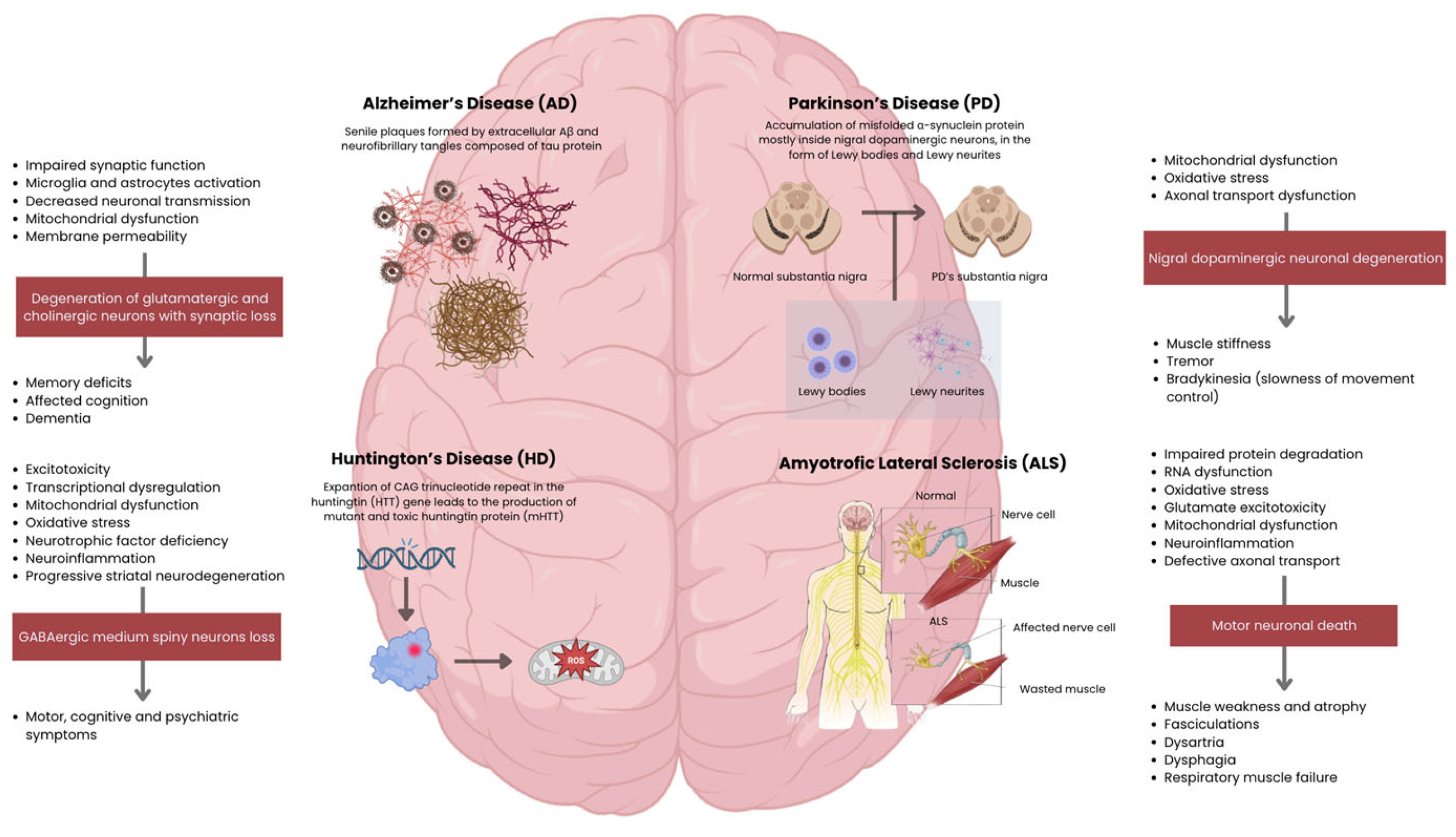图2：主要神经退行性疾病的病理生理机制和临床特征。侧边栏概述了从细胞功能障碍到特定神经元丢失以及随后的临床表现的进展过程。