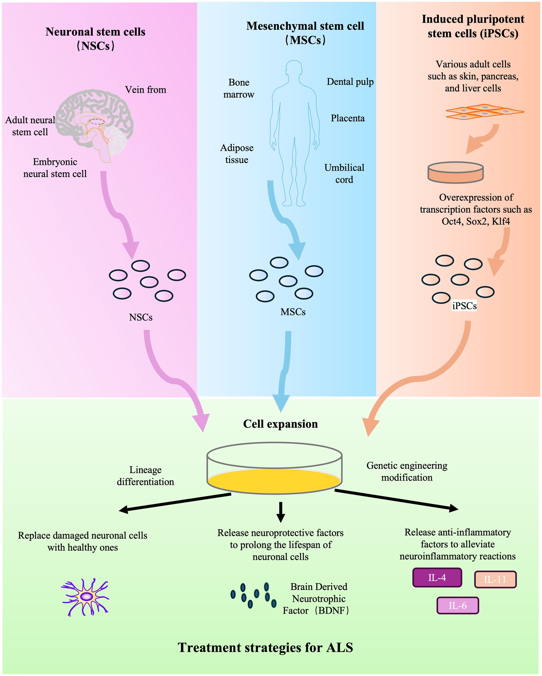 图2：干细胞疗法治疗ALS的示意图。