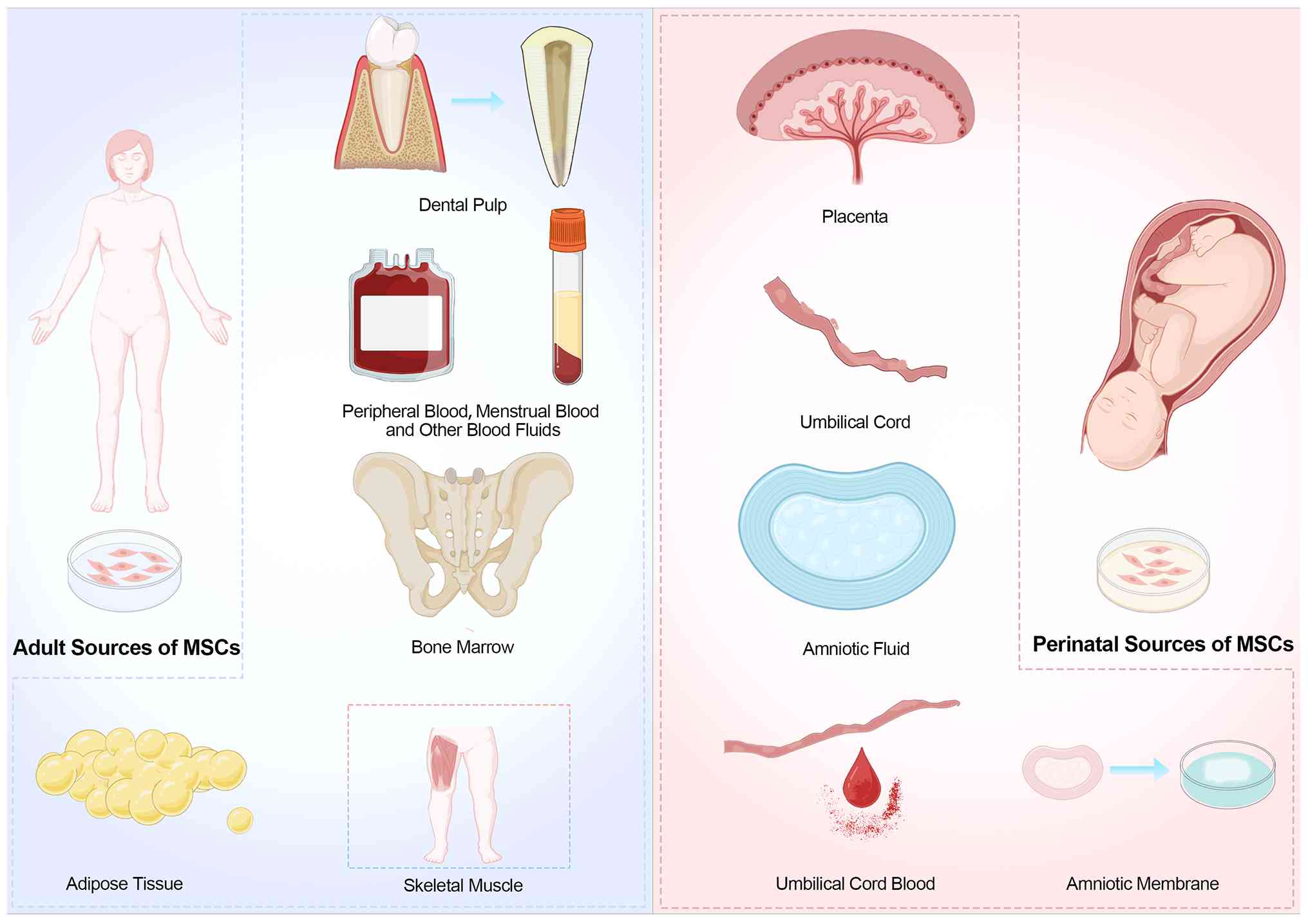 图2：间充质干细胞的来源。成人间充质干细胞可来源于骨髓、脂肪组织、外周血、骨骼肌和牙髓。围产期间充质干细胞通常取自胎盘、脐带、脐带血、羊水和羊膜。