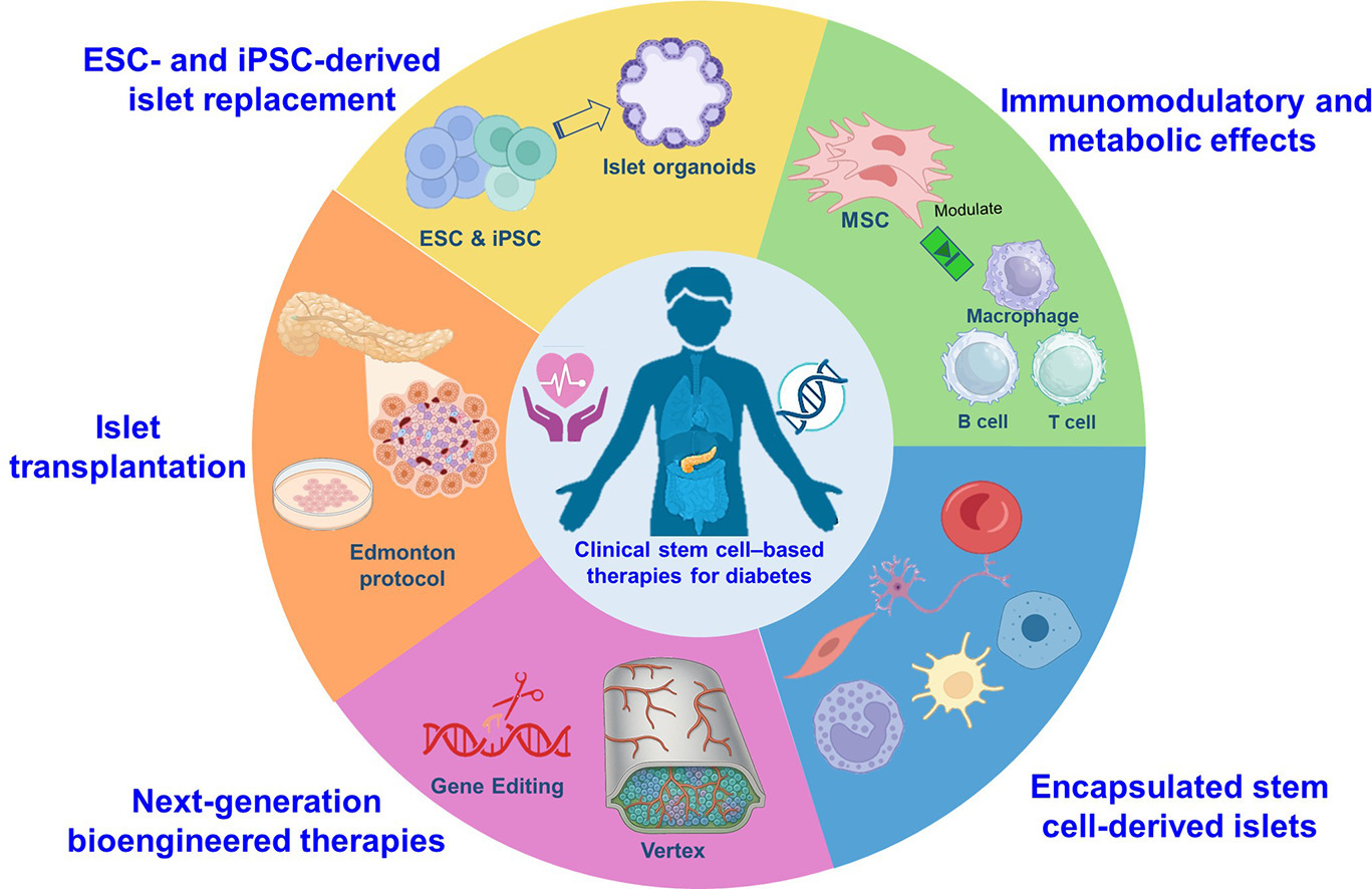 干细胞疗法重塑糖尿病治疗格局——主要临床试验概述与未来展望 干细胞疗法重塑糖尿病治疗格局——主要临床试验概述与未来展望