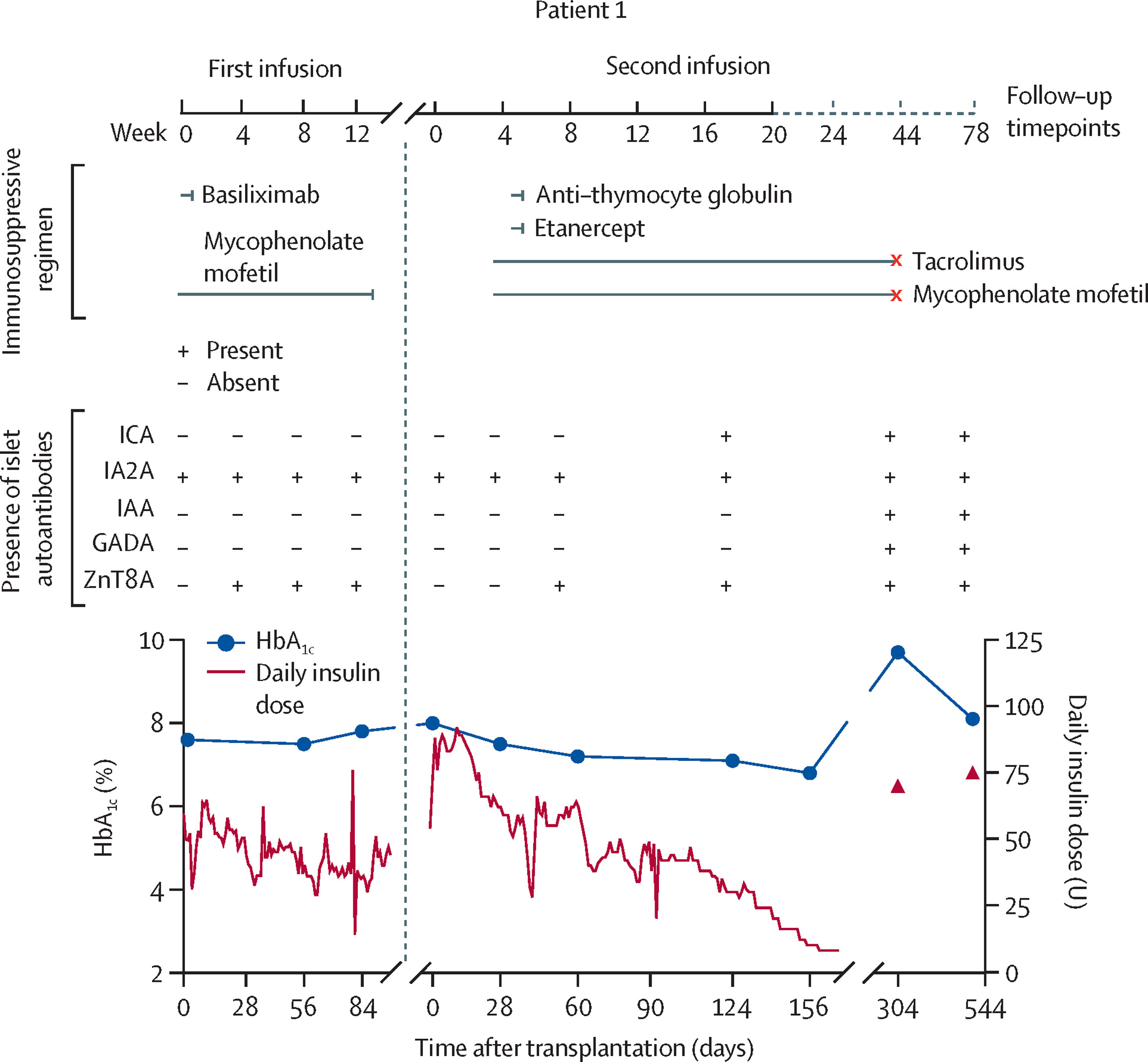 图1：自体和异体E-胰岛移植联合不同免疫抑制方案治疗患者1的疗效