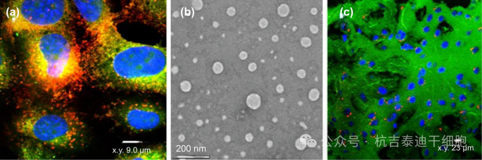 图1:细胞、组织和透射电镜 (TEM) 下的小型细胞外囊泡 (sEVs)。细胞产生的 sEVs(例如,外泌体)直径为 30–150 nm,可以穿过血脑屏障。 图1:细胞、组织和透射电镜 (TEM) 下的小型细胞外囊泡 (sEVs)。细胞产生的 sEVs(例如,外泌体)直径为 30–150 nm,可以穿过血脑屏障。