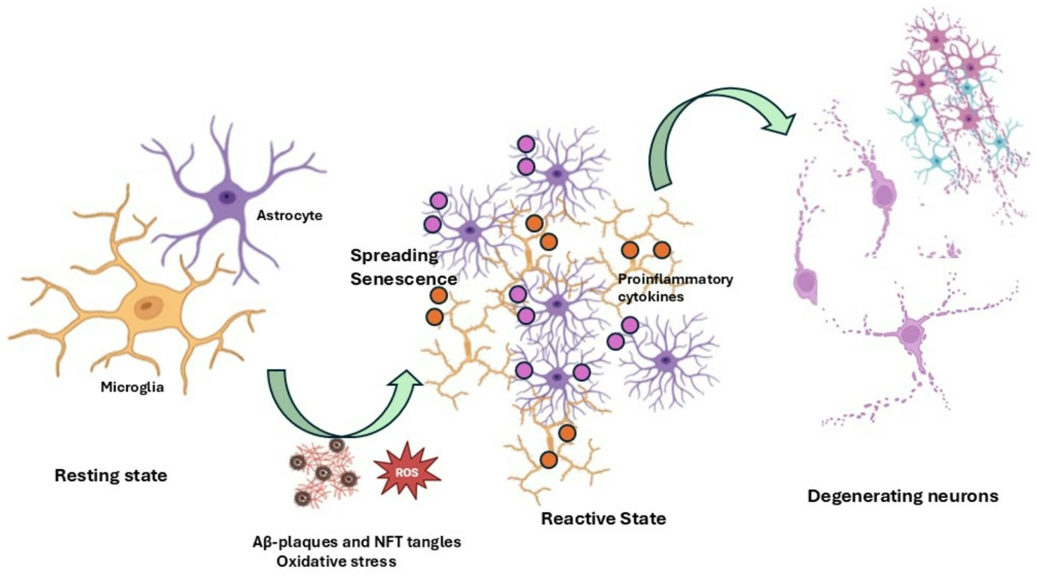 图2：胶质细胞衰老引发的神经炎症与神经元退化。示意图显示，在生理条件下，星形胶质细胞和小胶质细胞通过保持静息状态来协助神经元存活并维持大脑稳态。