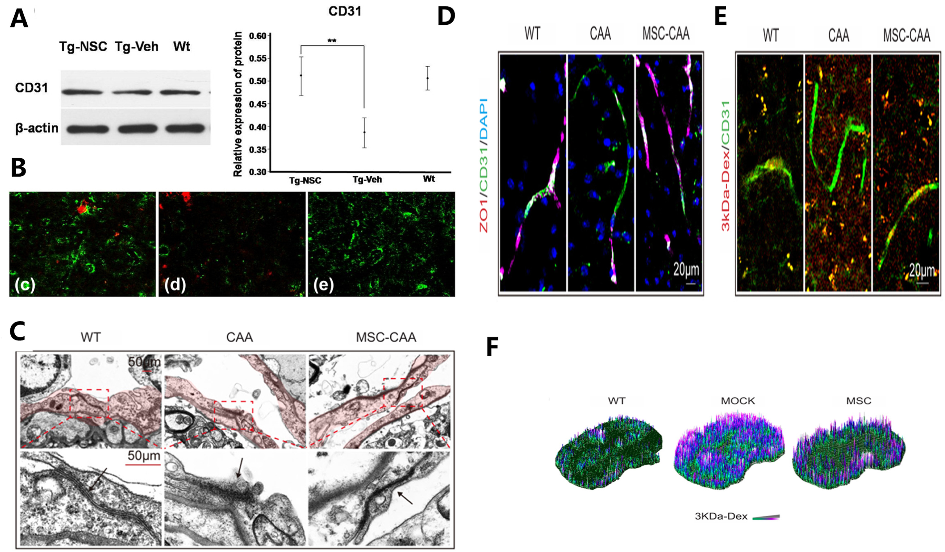 图4说明：干细胞修复血脑屏障并减少Aβ沉积的动物实验数据。