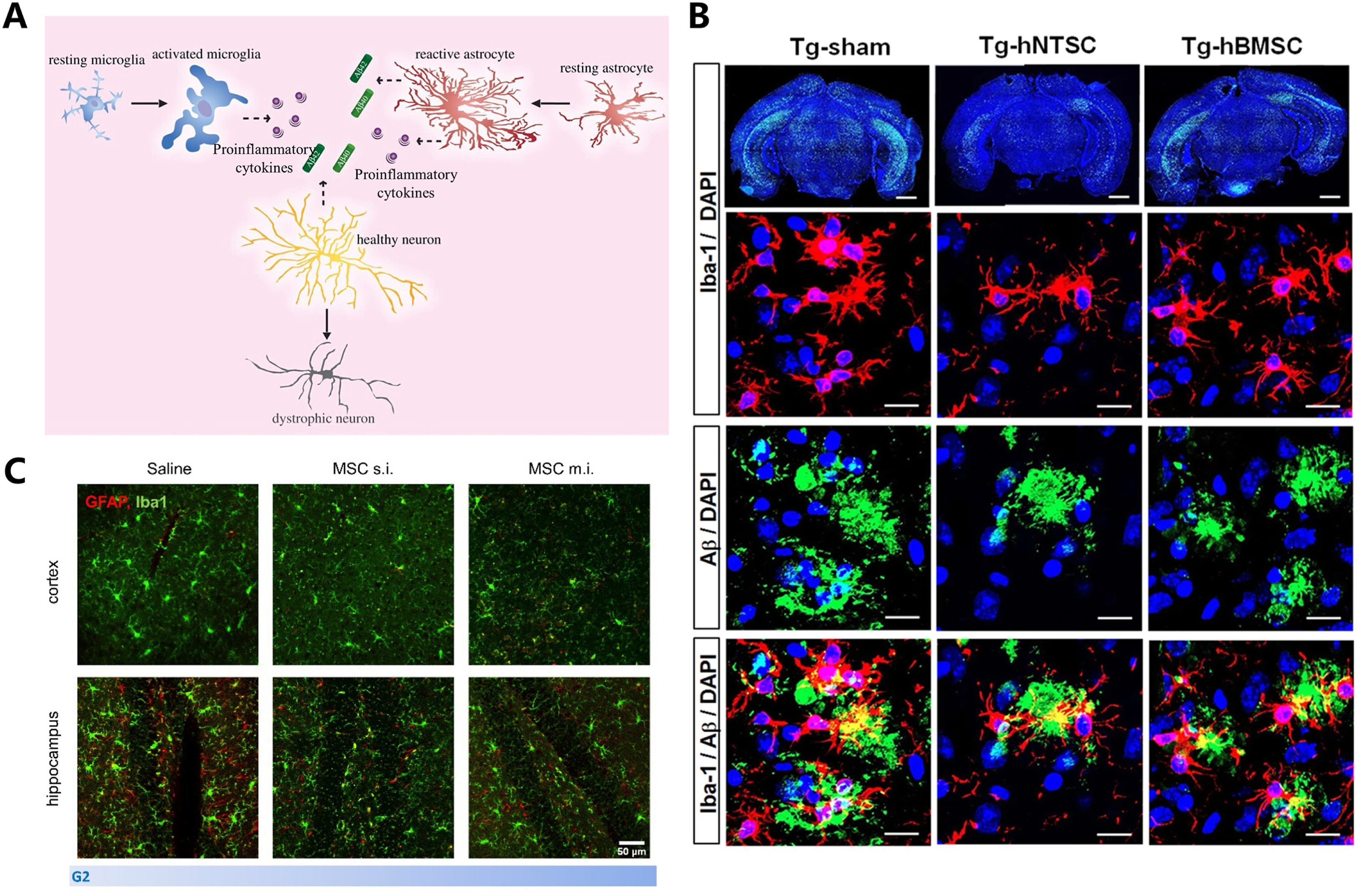 图3说明：干细胞对小胶质细胞和星形胶质细胞的免疫调节作用示意图。