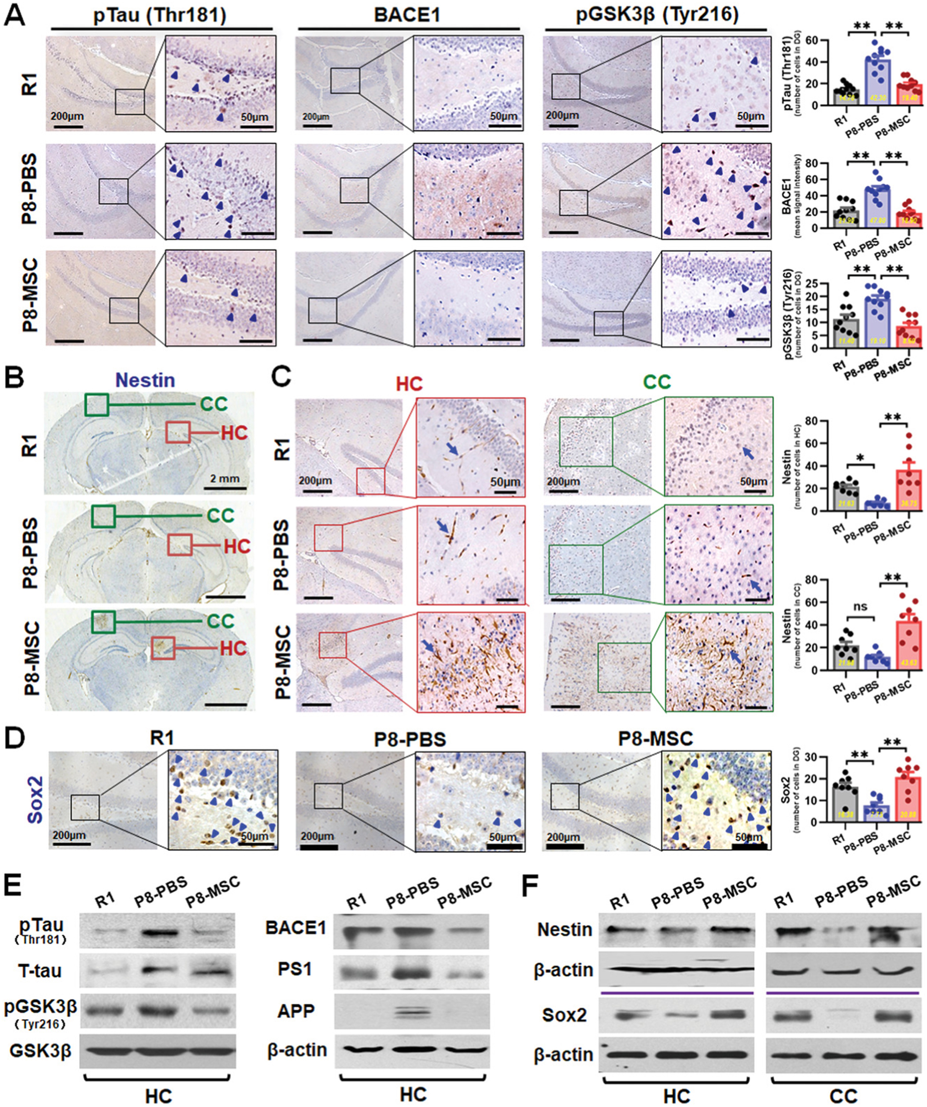 图2说明：hUC-MSCs调节AD相关关键蛋白的表达并改善SAMP8小鼠脑内的神经再生。