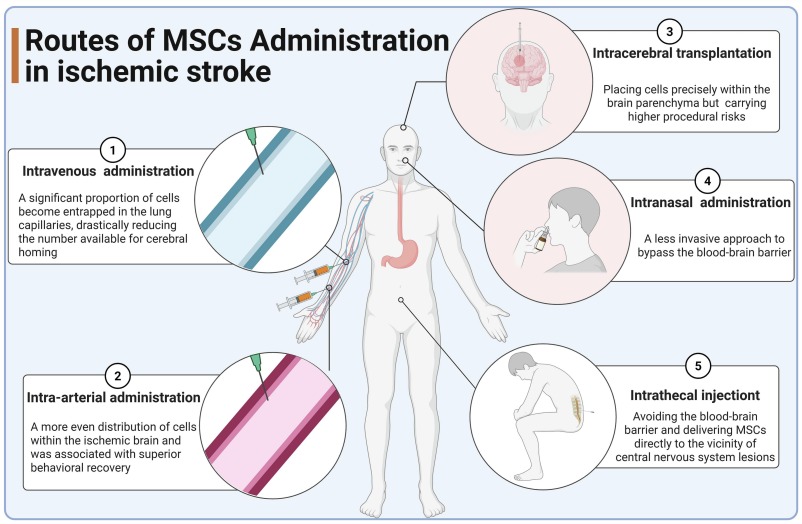图6：基于间充质干细胞 (MSC) 治疗缺血性卒中的主要给药途径示意图。该图展示了将MSC递送至大脑的主要策略，每种策略在靶向效率、侵入性和风险方面各有侧重。