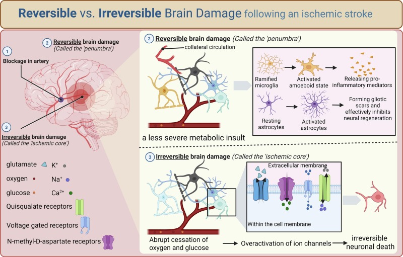 图1说明：缺血性卒中脑动脉闭塞后的病理生理分区