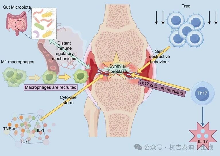 图1：类风湿关节炎 (RA) 的核心致病机制和炎症级联反应。免疫稳态的破坏和随之而来的全身性炎症驱动着RA的进展。
