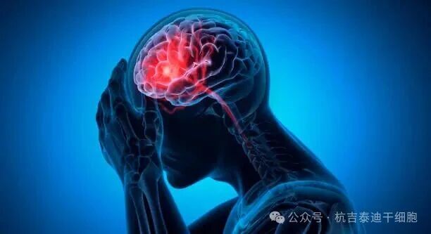 公众对干细胞治疗中风认知调查:80.77%认为有益,但疗效认知普遍不确定 公众对干细胞治疗中风认知调查:80.77%认为有益,但疗效认知普遍不确定
