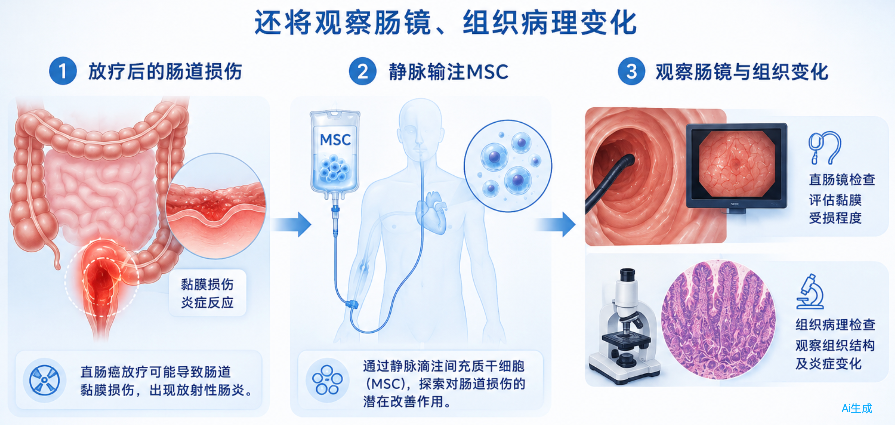 间充质干细胞治疗放射性直肠炎的过程